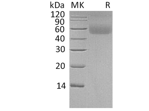 Recombinant Human LSAMP Protein (His Tag) - ABMIUM