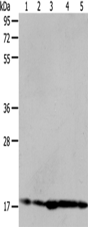 Anti-Human/Mouse/Rat ARF6 Antibody - ABMIUM