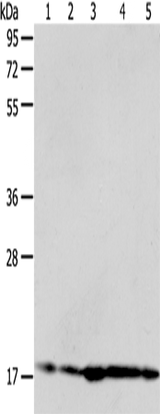 Anti-Human/Mouse/Rat ARF6 Antibody - ABMIUM