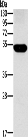 Anti-Human/Mouse FUCA1 Antibody - ABMIUM