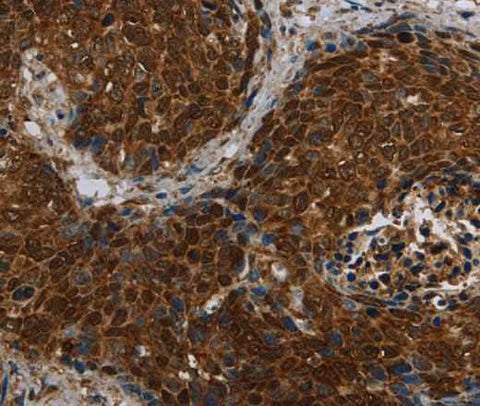 Anti-Human/Mouse CERS5 Antibody