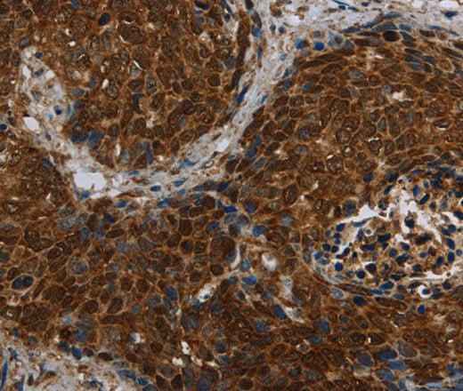 Anti-Human/Mouse CERS5 Antibody