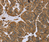 Anti-Human/Mouse/Rat IKBIP Antibody - ABMIUM