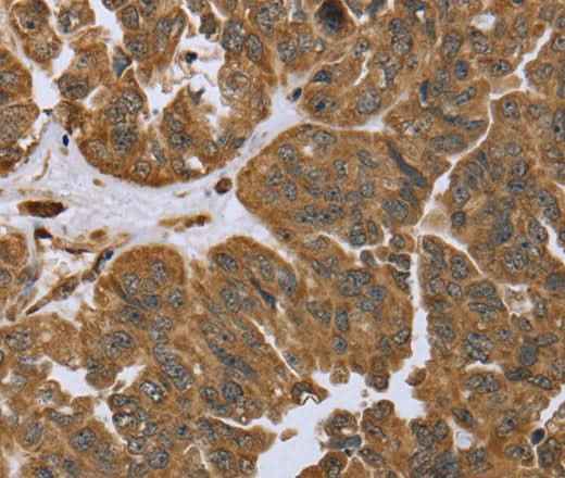 Anti-Human/Mouse/Rat IKBIP Antibody