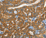 Anti-Human/Mouse EPHB3 Antibody - ABMIUM