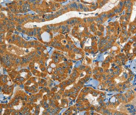 Anti-Human/Mouse EPHB3 Antibody