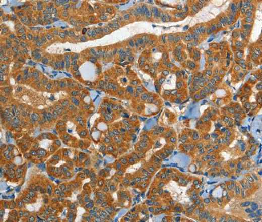 Anti-Human/Mouse EPHB3 Antibody