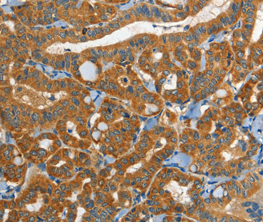 Anti-Human/Mouse EPHB3 Antibody - ABMIUM