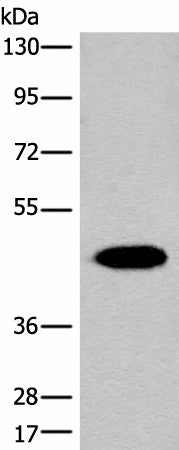 Western blot analysis of Human liver tissue lysate using FAH Polyclonal Antibody at dilution of 1:700