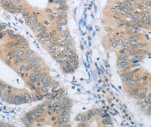 Anti-Human CHRNA10 Antibody - ABMIUM