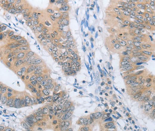 Anti-Human CHRNA10 Antibody - ABMIUM