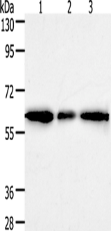 Anti-Human/Mouse/Rat AKR1A1 Antibody - ABMIUM