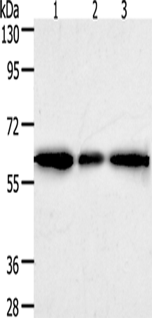 Anti-Human/Mouse/Rat AKR1A1 Antibody - ABMIUM