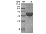 Recombinant Mouse CXADR/CAR Protein (AVI & His Tag) - ABMIUM