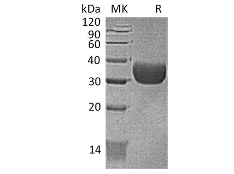 Recombinant Mouse CXADR/CAR Protein (AVI & His Tag) - ABMIUM