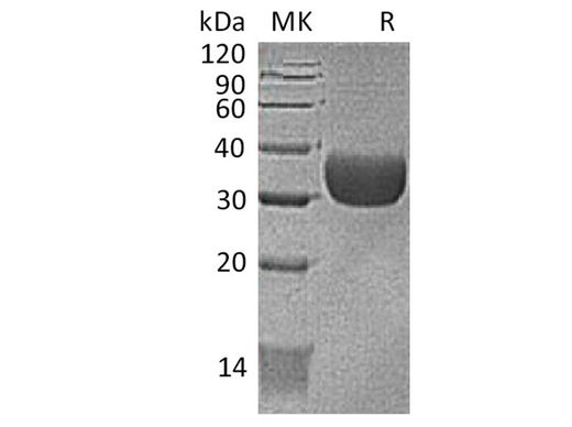 Recombinant Mouse CXADR/CAR Protein (AVI & His Tag) - ABMIUM