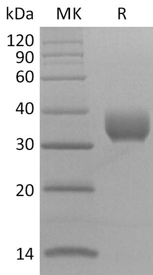Recombinant SARS-CoV-2 Spike RBD (V483A)(His Tag) - ABMIUM