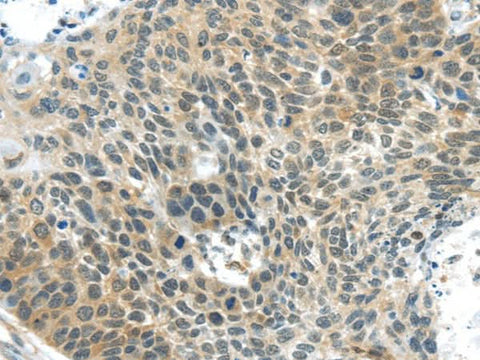 Anti-Human TSPY1 Antibody - ABMIUM