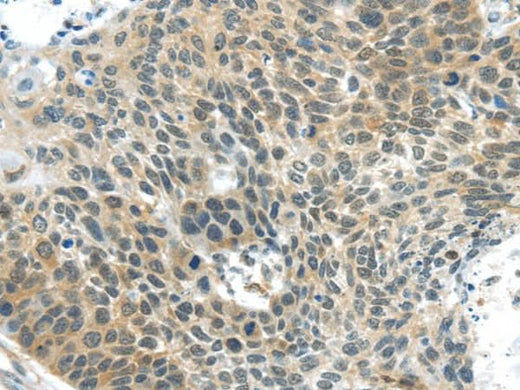 Anti-Human TSPY1 Antibody - ABMIUM