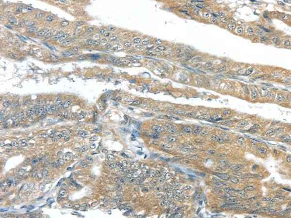 Anti-Human/Mouse/Rat AKT2 Antibody