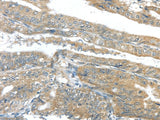 Anti-Human/Mouse/Rat AKT2 Antibody - ABMIUM