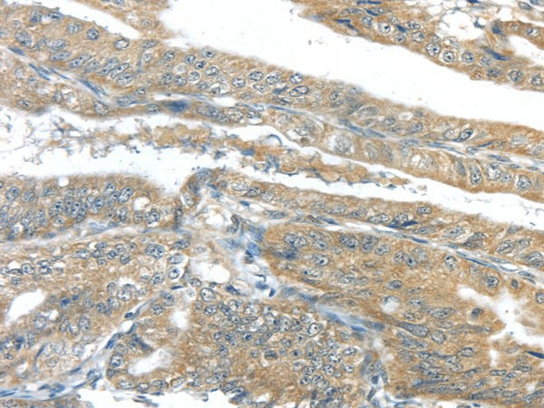 Anti-Human/Mouse/Rat AKT2 Antibody - ABMIUM