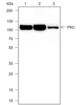 Anti-Human PKC mu Antibody [A705]