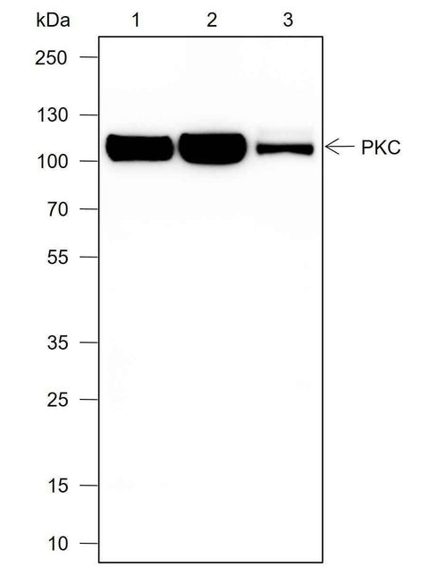 Anti-Human PKC mu Antibody [A705] - ABMIUM
