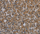 Anti-Human/Mouse MYO7A Antibody - ABMIUM