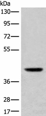 Western blot analysis of Mouse liver tissue lysate using USP12 Polyclonal Antibody at dilution of 1:700