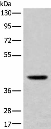 Western blot analysis of Mouse liver tissue lysate using USP12 Polyclonal Antibody at dilution of 1:700