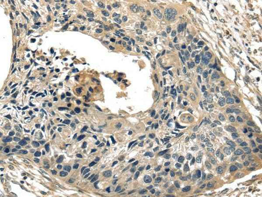 Anti-Human/Mouse/Rat TXNIP Antibody