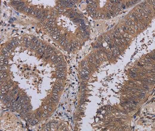Anti-Human/Mouse P3H3 Antibody