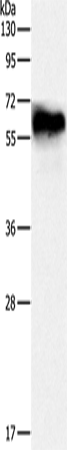 Anti-Human/Mouse/Rat DPYSL4 Antibody - ABMIUM