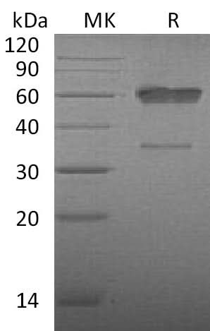 Recombinant Mouse CD83/HB15 Protein (aa 22-134, Fc Tag) - ABMIUM