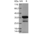 > 82 % as determined by reducing SDS-PAGE.