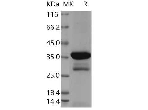 > 82 % as determined by reducing SDS-PAGE.