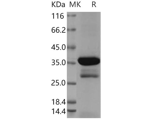 > 82 % as determined by reducing SDS-PAGE.