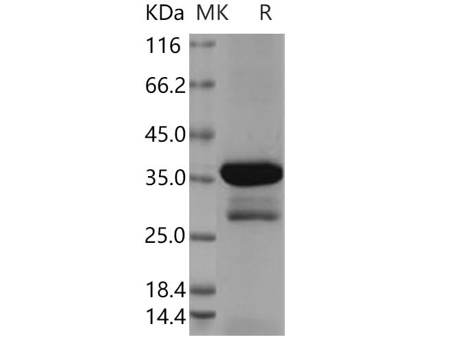 > 82 % as determined by reducing SDS-PAGE.