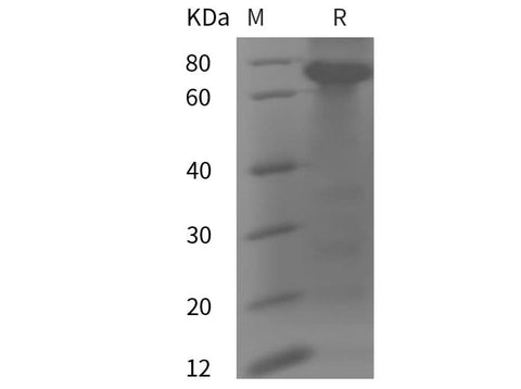 SDS-PAGE analysis of Human CHGA proteins, 2 μg/lane of Recombinant Human CHGA proteins was resolved with SDS-PAGE under reducing conditions, showing bands at 75 kDa.