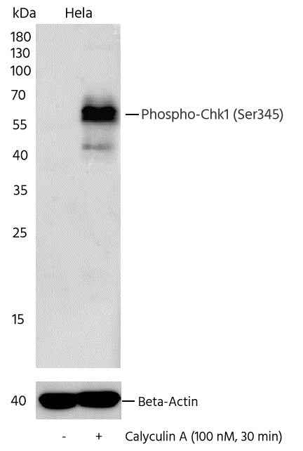 Anti-Human CHEK1 Antibody [B292] - ABMIUM