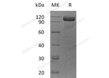 Recombinant Human EGFR/ErbB1 Protein (Fc Tag) - ABMIUM
