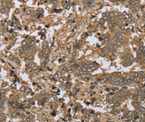 Anti-Human/Mouse/Rat IKBIP Antibody - ABMIUM
