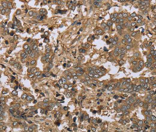 Anti-Human/Mouse/Rat IKBIP Antibody