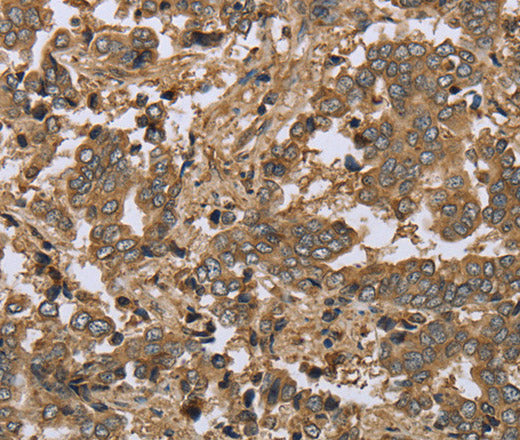Anti-Human/Mouse/Rat IKBIP Antibody - ABMIUM