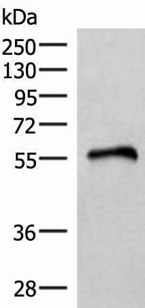 Anti-Human/Mouse/Rat RETREG1 Antibody