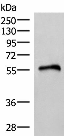 Western blot analysis of Human heart tissue lysate using RETREG1 Polyclonal Antibody at dilution of 1:400