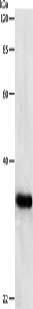Anti-Human/Mouse/Rat PCNA Antibody - ABMIUM