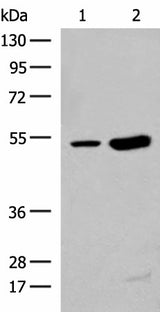 Western blot analysis of Human left thymus tissue and Mouse kidney tissue lysates using ZBTB43 Polyclonal Antibody at dilution of 1:250