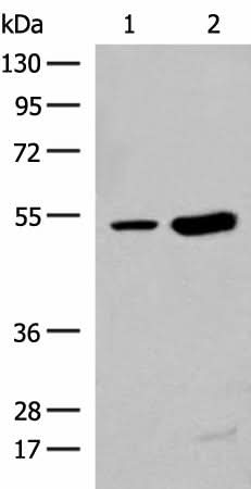 Western blot analysis of Human left thymus tissue and Mouse kidney tissue lysates using ZBTB43 Polyclonal Antibody at dilution of 1:250